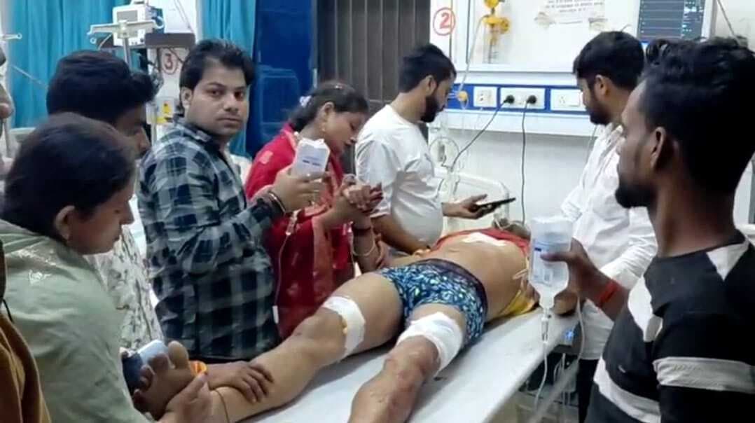 Sasaram News : दुकान में स्वर्ण व्यवसायी व उसके बेटे को अपराधियों ने मारी गोली