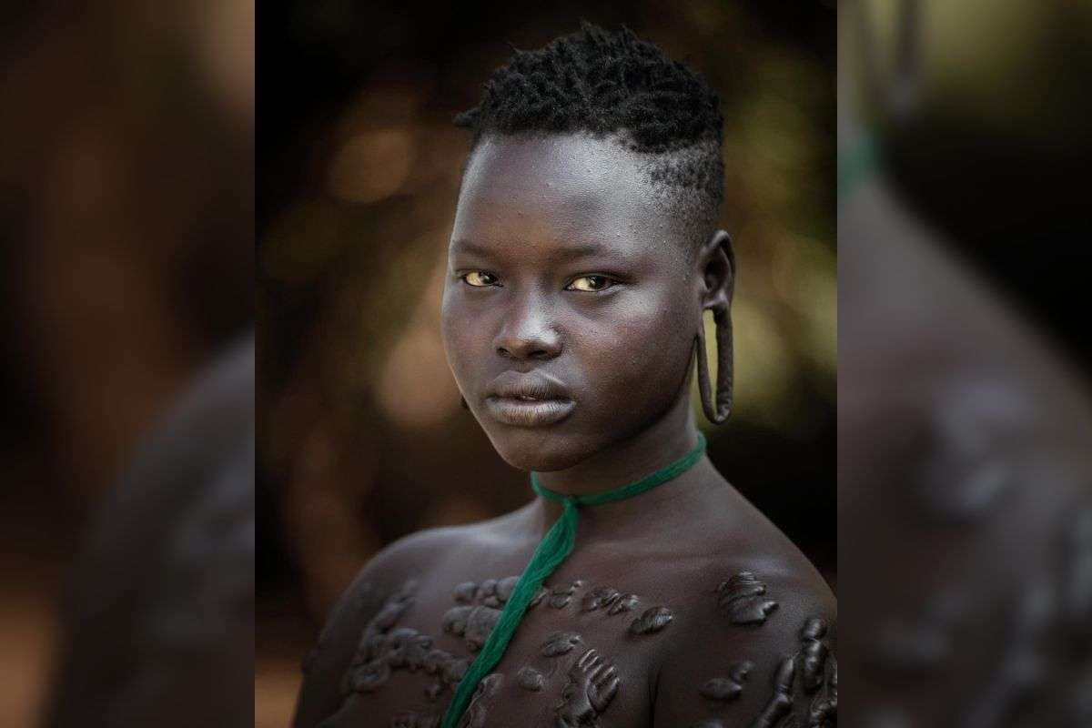 शरीर पर घाव के निशान वाला एक युवक. 