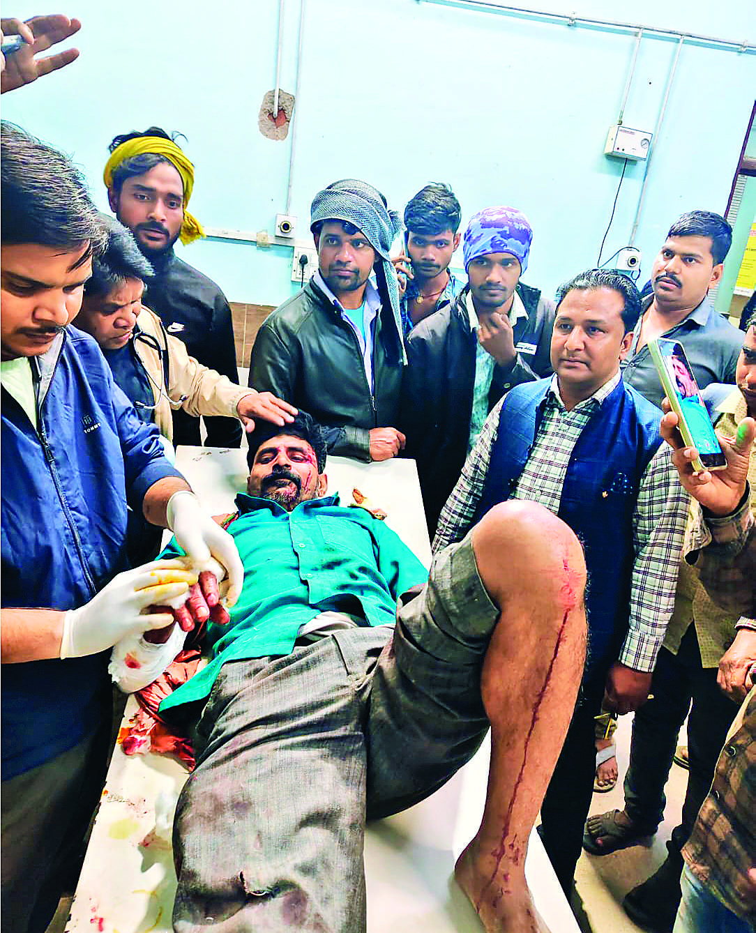 कोचस में तेंदुए के हमले से छह लोग घायल