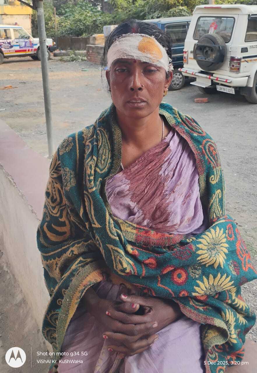 छोटी बहन के पति पर मारपीट करने का आरोप