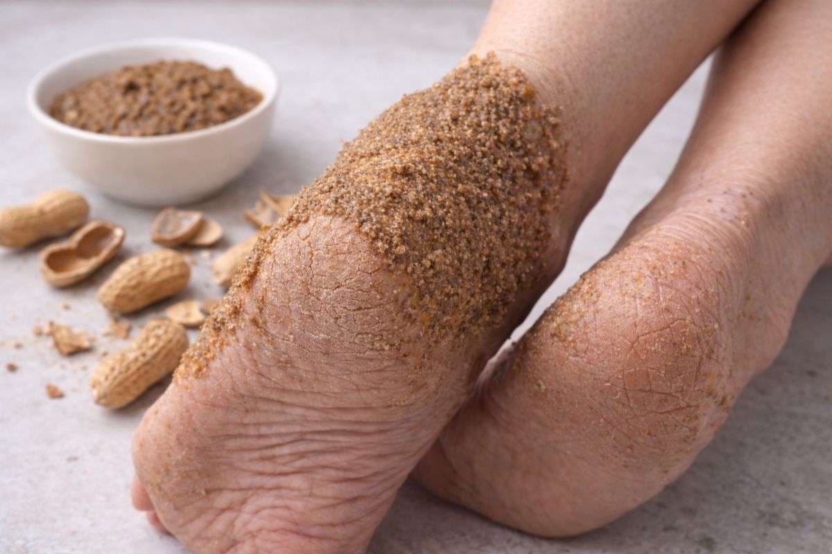 Mungfali Ke chilke Ka foot mask For Cracked Heels: अब फटी एड़ियों की छुट्टी! मूंगफली के छिलके से बनाएं नेचुरल फुट मास्क