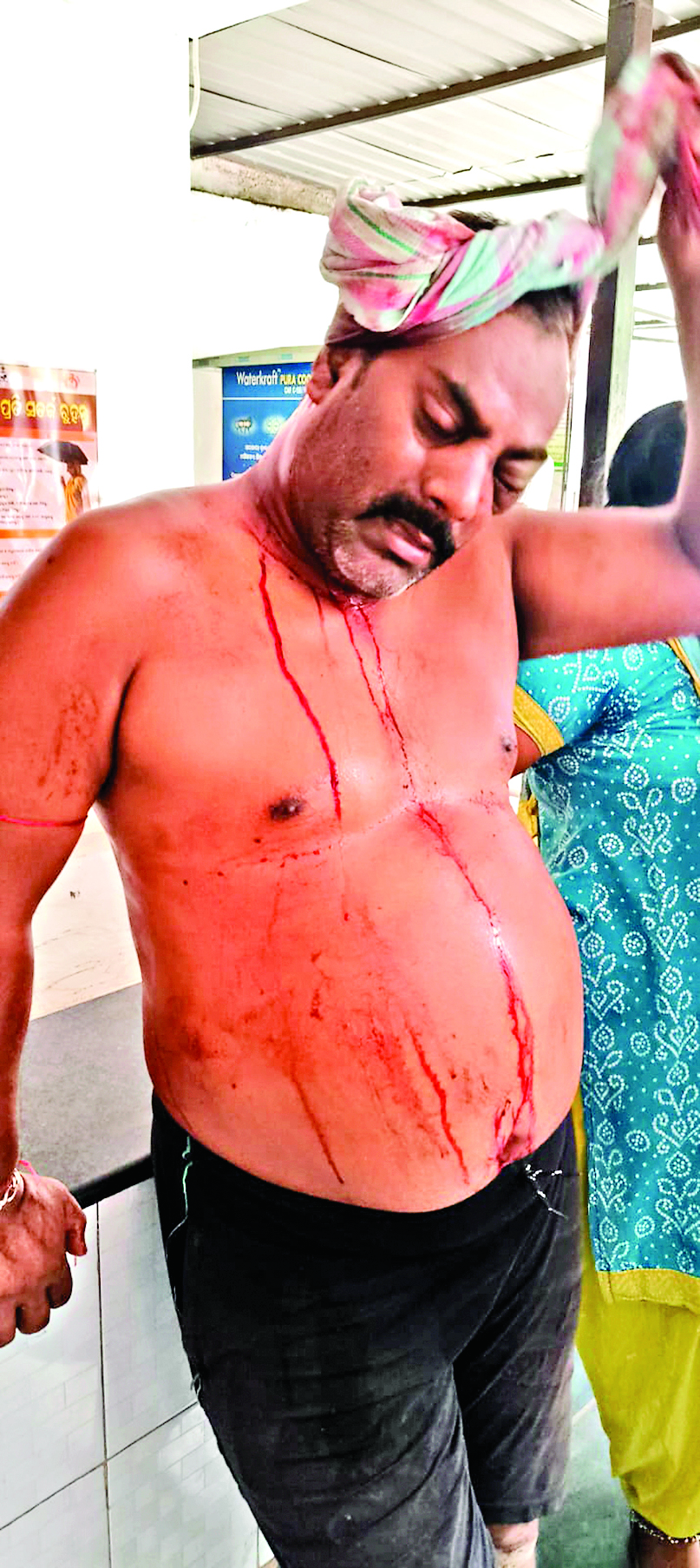 Rourkela News: मालगोदाम बस्ती में जमीन विवाद को लेकर दो परिवारों में मारपीट, एक व्यक्ति घायल