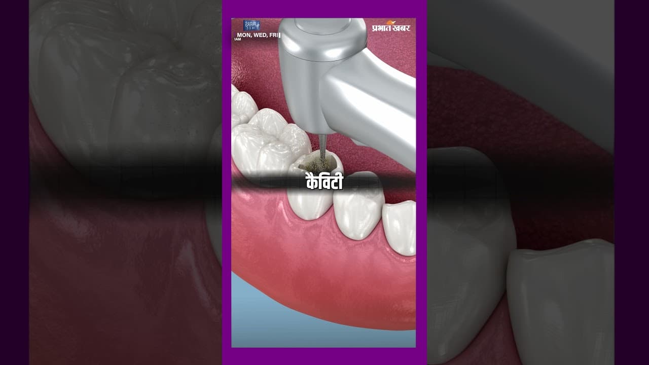 Young लोगों के दांतों में इतनी Cavities क्यों बढ़ रही हैं? Dentist से जानिए | Healthy Life Season 1