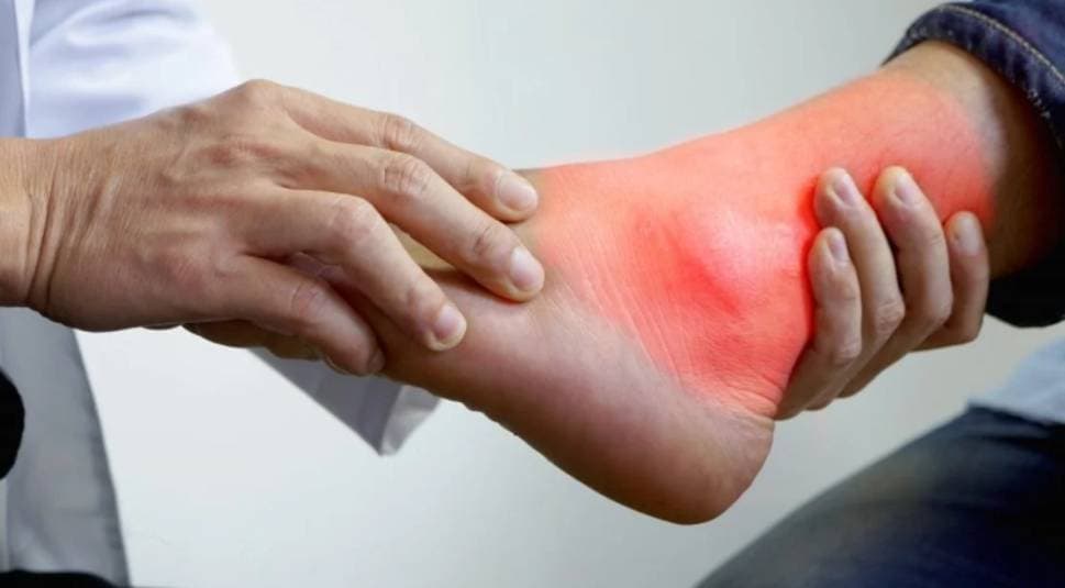 Uric Acid Control Tips: यूरिक एसिड को नियंत्रित करने के घरेलू उपाय, मिलेगी राहत