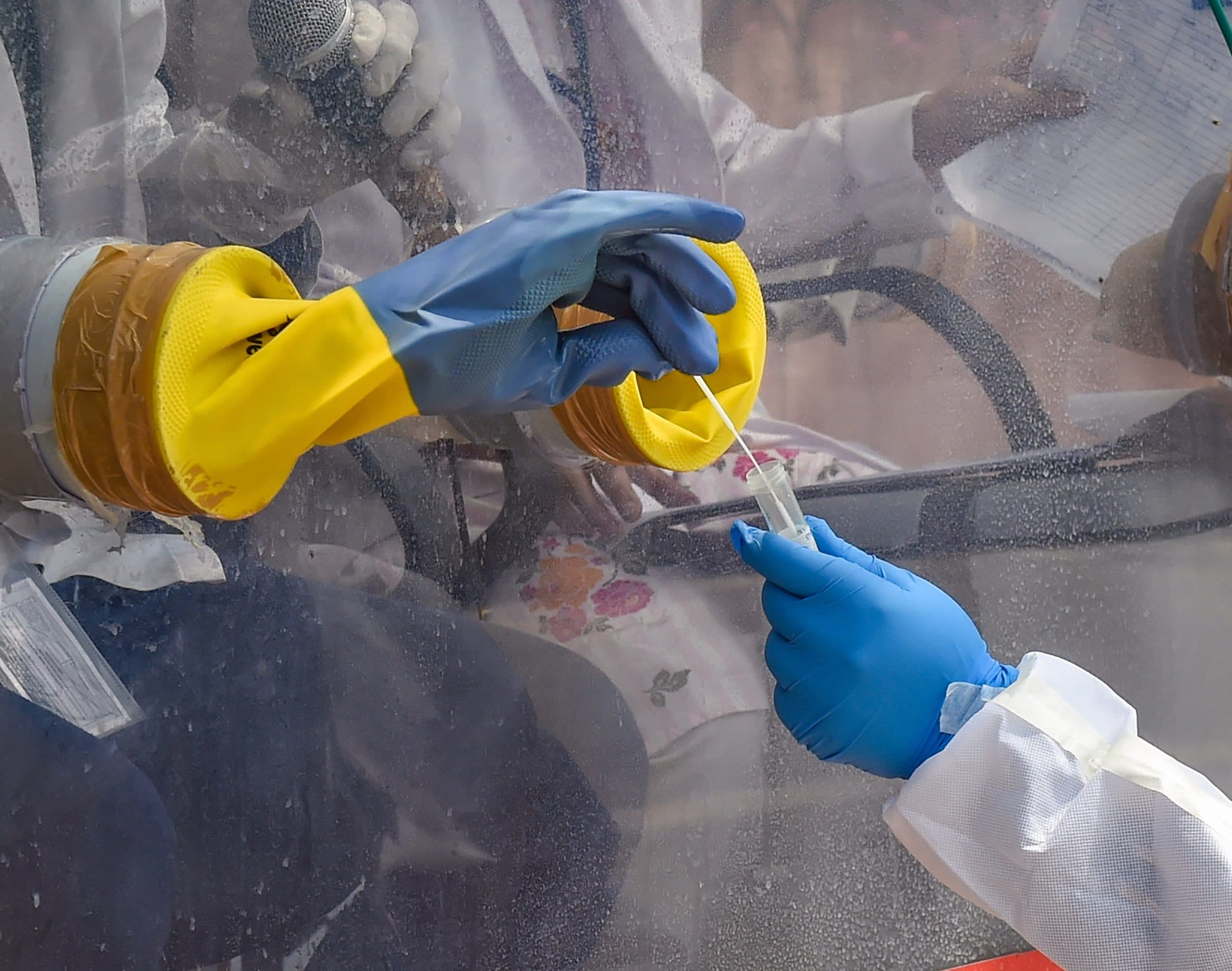 Corona Virus in UP: कोरोना के नये स्ट्रेन ने बढ़ाई मुसीबत, 20 हजार पार हुई संक्रमितों की संख्या, मरीजो की देखभाल के लिए लगेगी एमबीबीएस छात्रों की भी ड्यूटी