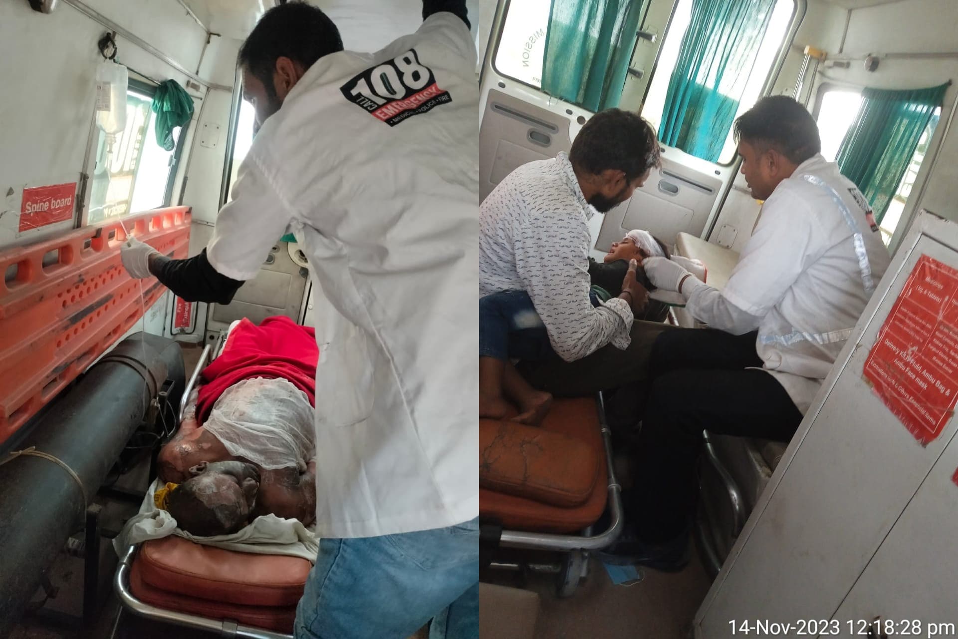 UP News: दीपावली पर 183 लोग पटाखों व अन्य कारणों से जले, 108 एंबुलेंस ने पहुंचाई मदद