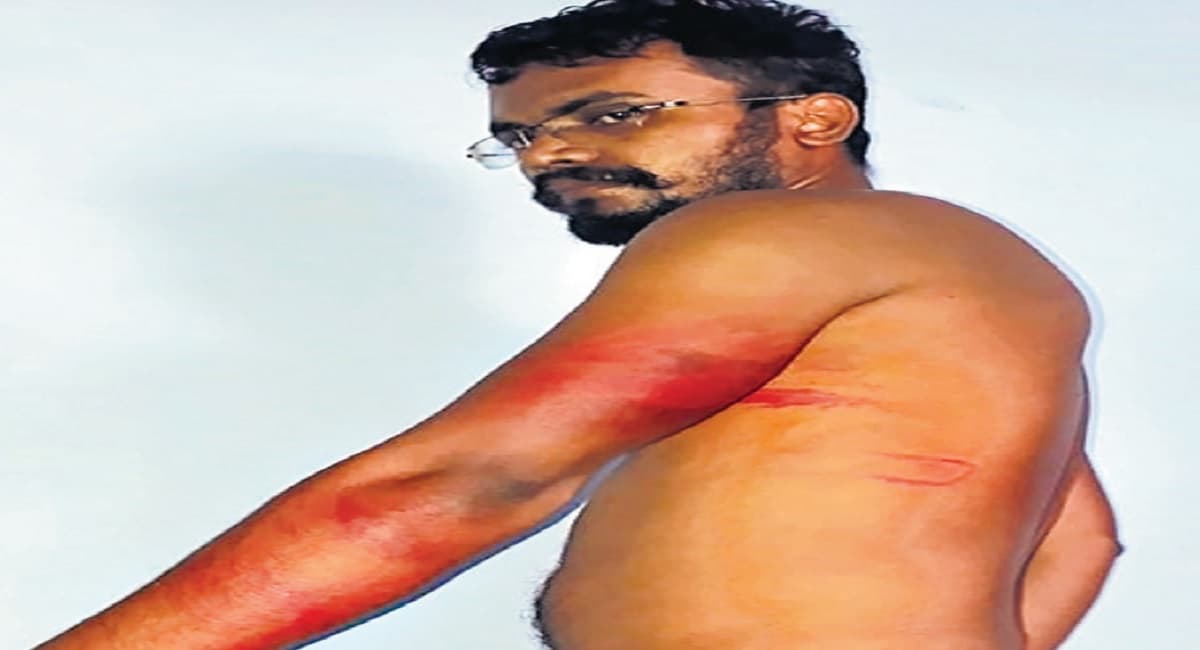 Bihar News: दूसरे के बदले परीक्षा दे रहे स्कॉलर को सेंटर पर जमकर पीटा, सुपरिटेंडेंट समेत तीन पर केस दर्ज