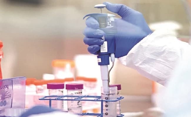 यूपी के शामली से राहत वाली खबर, आगरा में 25 तो गौतमबुद्ध नगर से 4 मामले आए सामने