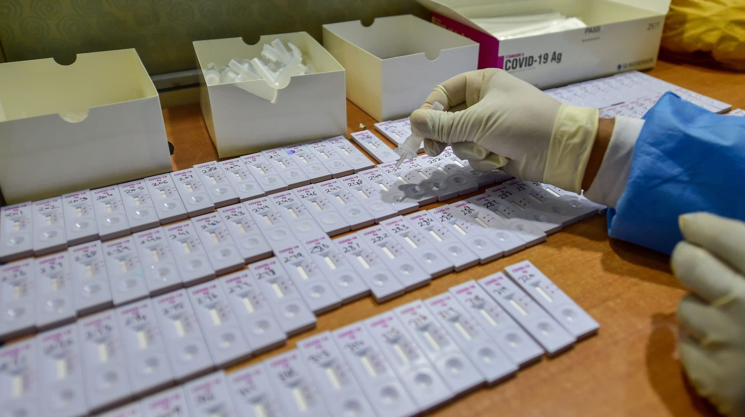 कोरोना पॉजिटिव आने के बाद दोबारा नहीं होगा RTPCR टेस्ट, जानिए क्या है आईसीएमआर की नई एडवाइजरी