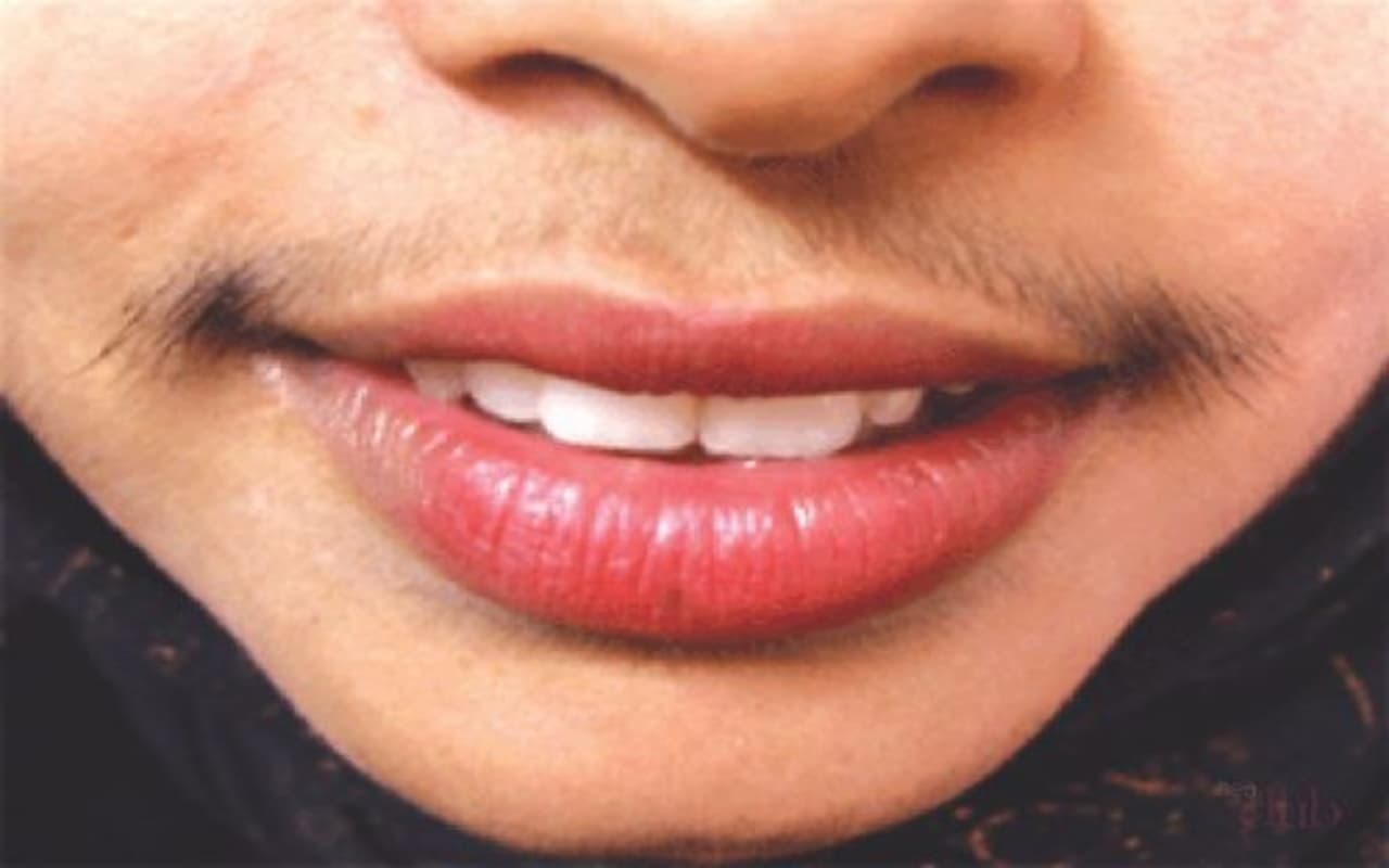 Beauty Tips: पार्लर को कहें बाय-बाय, इन नुस्खों को अपनाकर हटायें अपर लिप्स के बाल