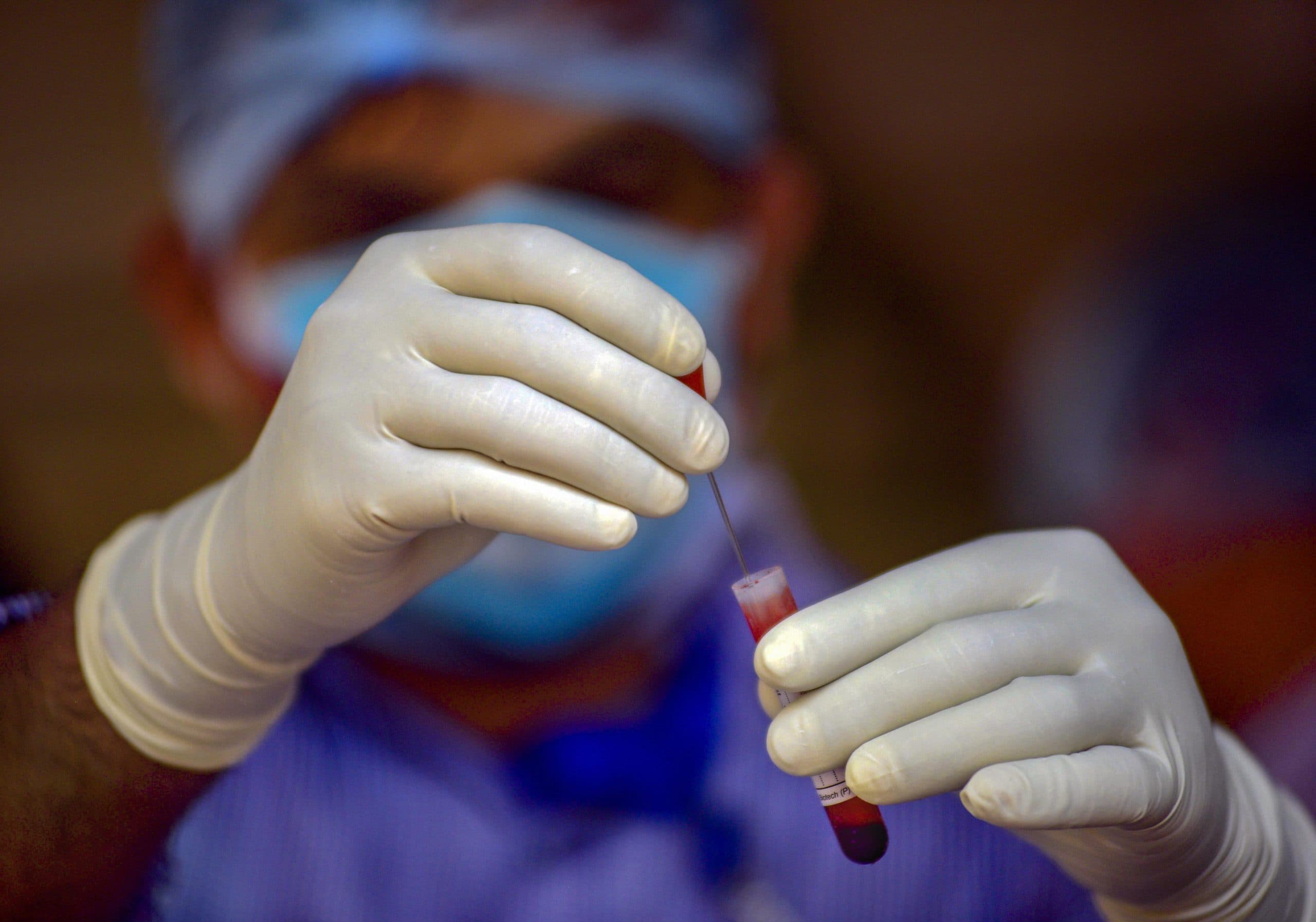 भारत में ऐसे हार रहा कोरोना वायरस, इन बातों से मिल रहे संकेत