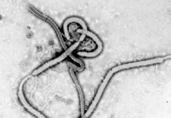 अमेरिका भी नहीं बचा पाया इबोला के मरीज को