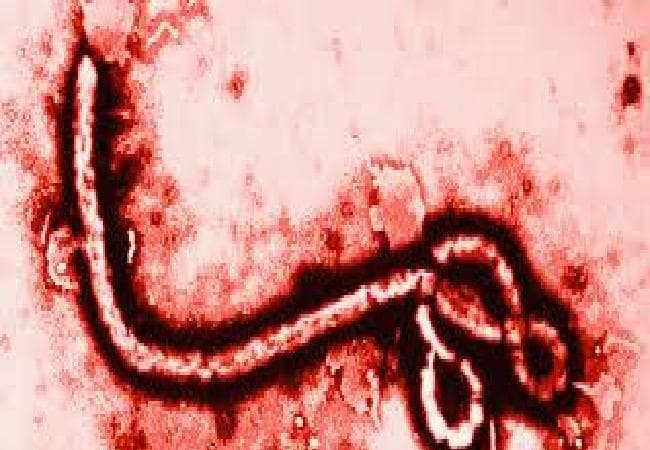 नये अध्ययन से हुआ खुलासा, इबोला की रोकथाम के लिए 21 दिन काफी नहीं