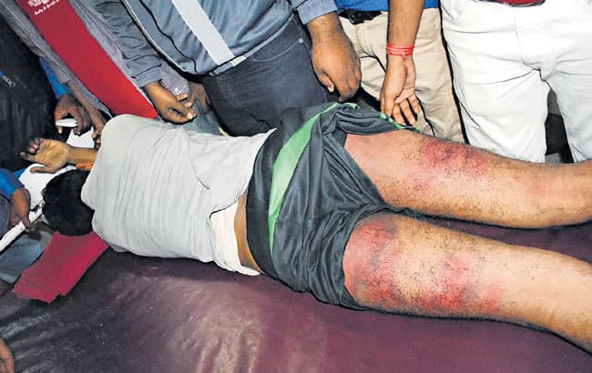 पुलिस की बर्बरता: रात में तीन बजे छात्रों को उठाया नंगा कर पीटा, सिगरेट से दागा