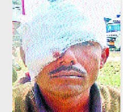 छेड़खानी का विरोध करने पर फोड़ दी आंख
