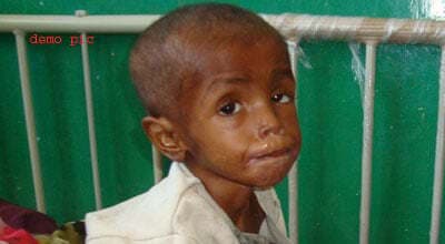 ओंटारियो में मिला दो साल से बेडरुम में बंद कुपोषित बालक