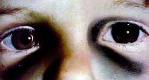 झारखंड, बिहार के बच्चों को केरल के अनाथालय से बचाया गया