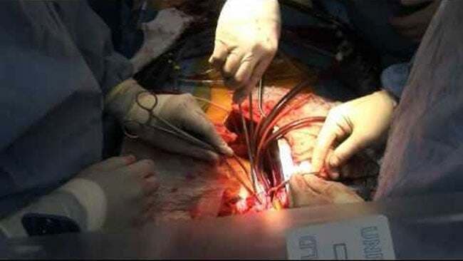 गूगल ग्लास से हुई हार्ट सर्जरी