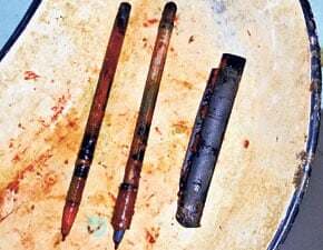 युवक के पेट से निकले एक चाकू व दो कलम