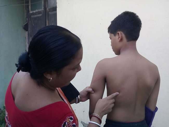 स्कूल शिक्षक की पिटाई से छात्र अस्वस्थ