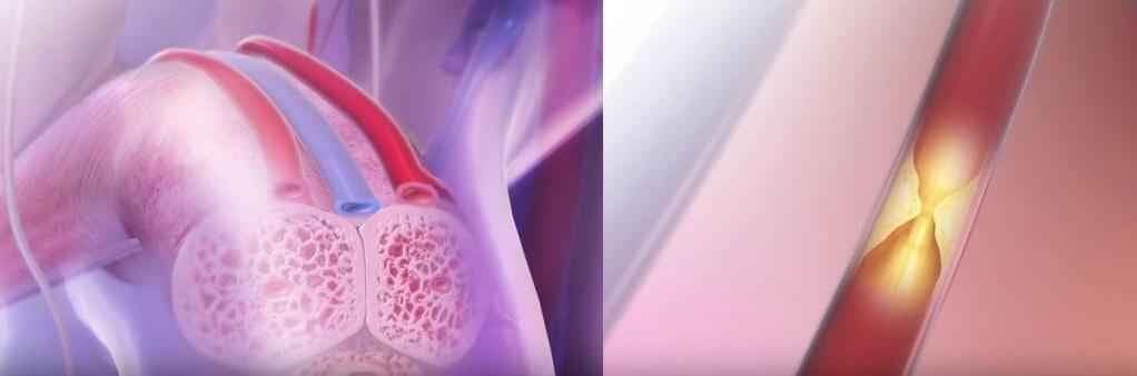 टेंशन और अनियमित लाइफस्टाइल बढ़ाती है नसों में कमजोरी