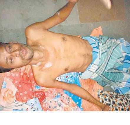 गैस सिलिंडर लीक होने से लगी आग से चार लोग बुरी तरह झुलसे