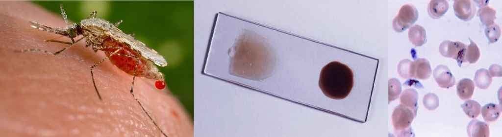 अब मच्छर ही करेगा मलेरिया का इलाज