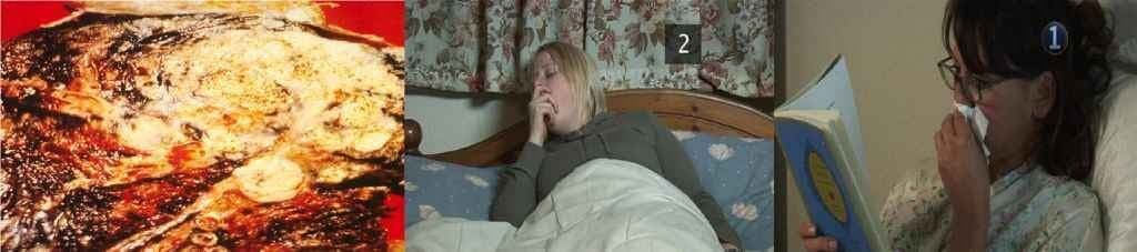 सावधान...सर्दी-जुकाम भी हो सकता है कैंसर का कारण!