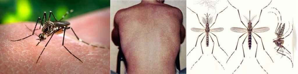 और आ गया ‘दुनिया का पहला डेंगू रोधी टीका’