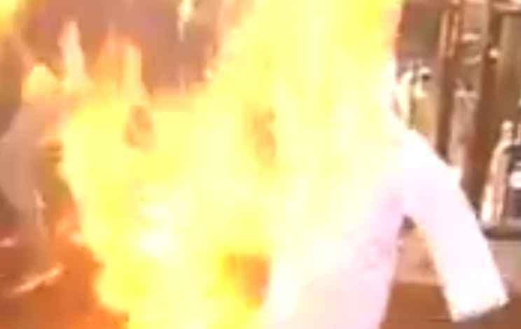 नरेंद्र मोदी का पुतला फूंकने के दौरान जले कांग्रेसी कार्यकर्ता