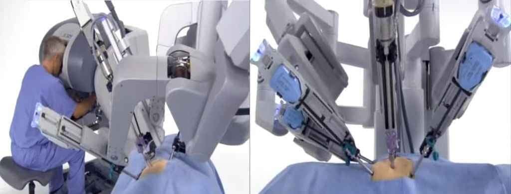 अब भारत में भी रोबोटिक सर्जरी संभव