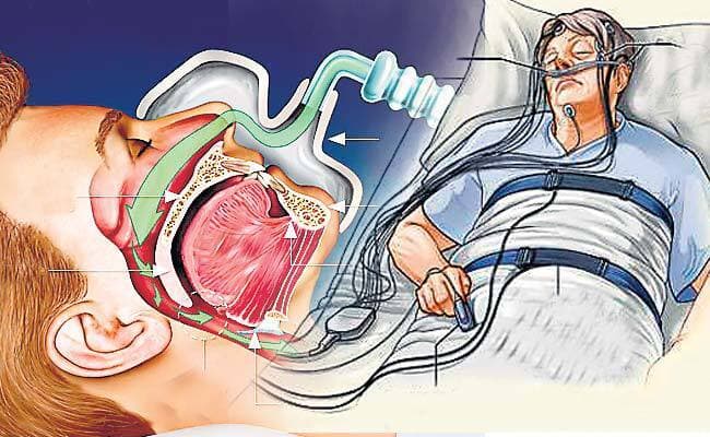 खतरनाक है खर्राटे वाली नींद