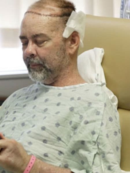 डॉक्टरों ने पहली बार किया इंसानी खोपड़ी का सफल प्रत्यारोपण, वीडियो में देखें पूरी सच्चाई