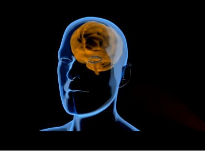 जाने क्या है ‘एफैंटेसिया’ (Aphantasia)