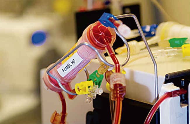 अब खून हो सकेगा फिल्टर