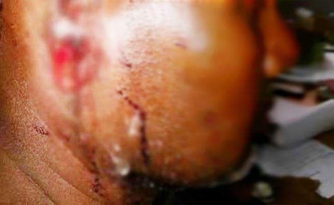 दमदम कैंट : जुआरियों ने युवक का कान काटा