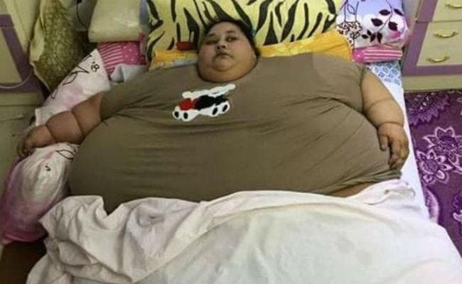 500 KG की मिस्र की महिला को सुषमा ने दिलाया वीजा, अब भारत में होगी सर्जरी