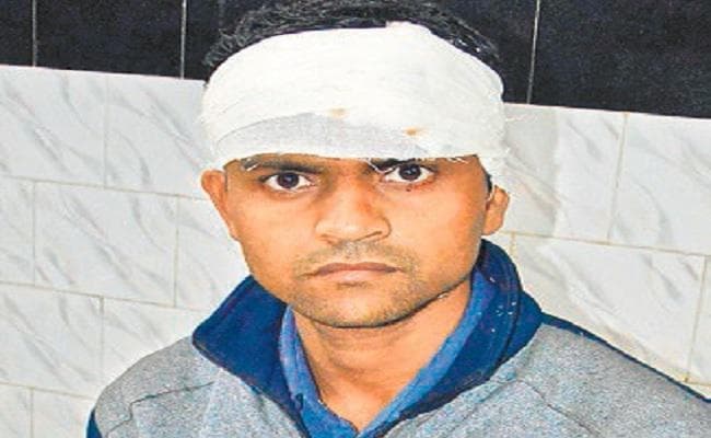 पुलिस की गुंडागर्दी, गाड़ी नहीं रोकी तो डंडा मार कर फोड़ा सिर
