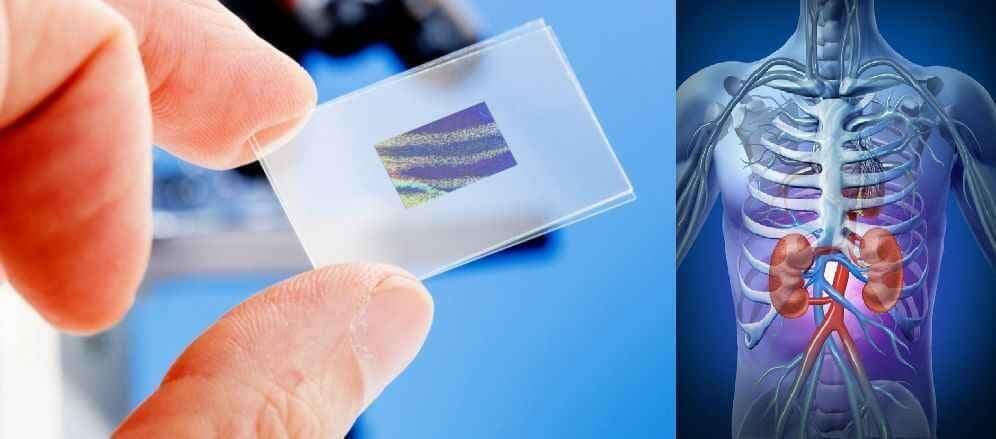 किडनी रोगियों के लिए जरुरी नहीं अब ‘डायलिसिस’