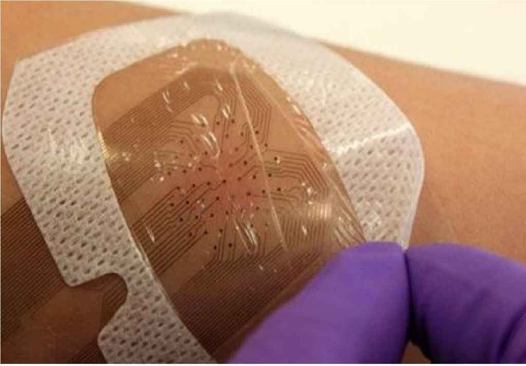 डॉक्टर की तरह आपकी चोट का ख्याल रखेगी ‘स्मार्ट बैंडेज’