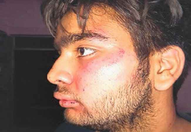 बाइकर्स ने छात्र को उठाया, 20 हजार रुपये लेकर छोड़ा