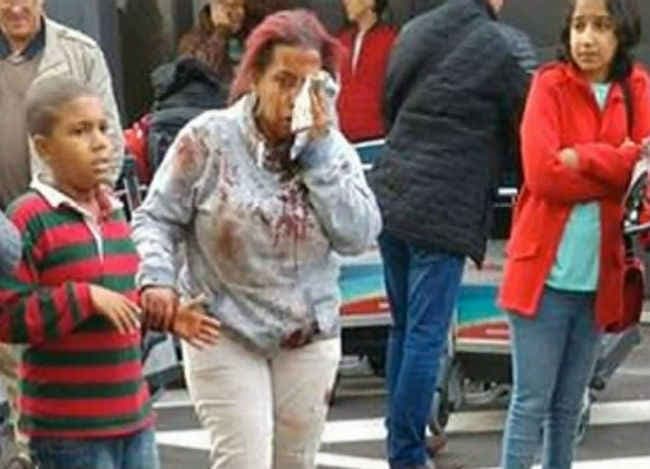 बेल्जियम हमले के हताहतों की संख्या 31 हुई, और बढने की आशंका