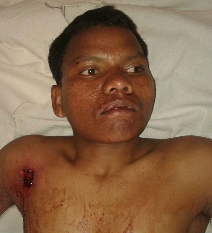 गढ़वा में मुठभेड़ में माओवादी घायल, गिरफ्तार