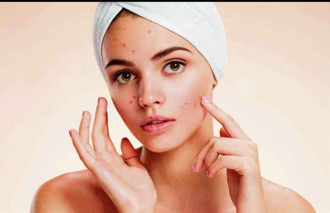 आसान उपायों से दूर करें त्वचा की समस्याएं
