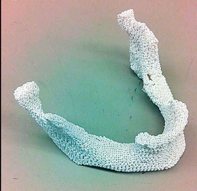 3डी प्रिंटिंग से बन सकेंगी हड्डियां