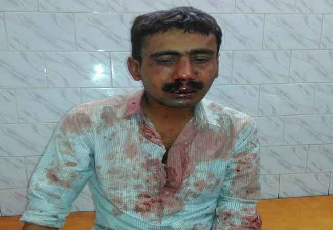 बिहार : पटना में मीडियाकर्मी पर हमला मामले में अबतक 3 गिरफ्तार, एक फरार