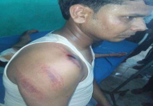 बिहार : मधेपुरा में पुलिस ने पत्रकार को बेरहमी से पीटा
