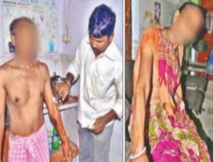 बिहार : लड़की को उठाने में असफल रहे बदमाशों ने परिजनों पर फेंका खौलता तेल