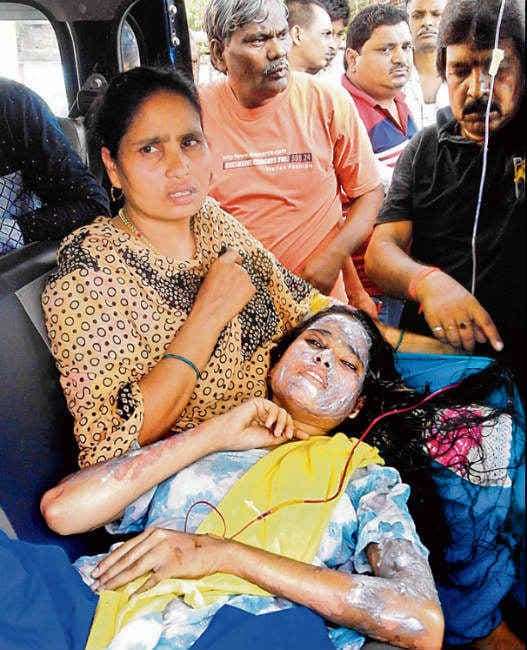 घर में सोयी छात्रा पर फेंका तेजाब, मां भी झुलसी