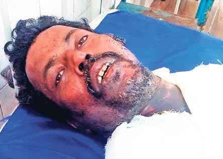 हावड़ा : बकाया मांगने पर बावर्ची को जलाया